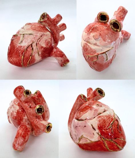Heart Of Gold