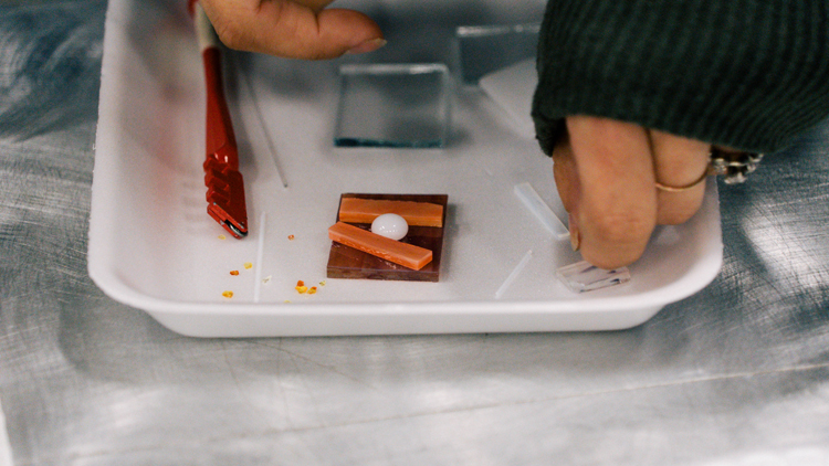 36