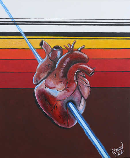 Laser Through the Heart